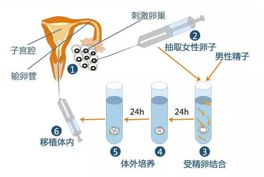 供卵试管婴儿宫颈口短是什么意思-供卵试管婴儿宫颈口短是什么意